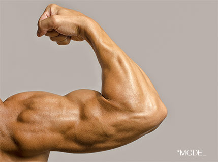 Biceps Implants for Men